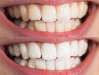 Slow Cosmétique : Des dents blanches au naturel