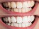 Slow Cosmétique : Des dents blanches au naturel